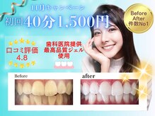 ホワイトニングショップ 福岡春日店