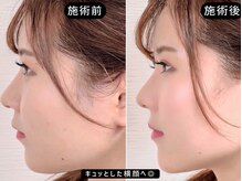 アオヤマ サロン ワイゼット(AOYAMA SALON YZ)