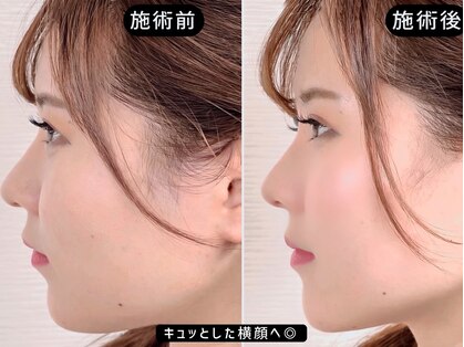 アオヤマ サロン ワイゼット(AOYAMA SALON YZ)の写真