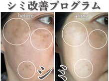 エステサロンパリス(Esthe Salon Paris)