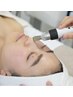 【20代30代】繰り返す敏感ニキビ・毛穴ケア AI肌分析+毛穴洗浄付