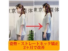東京G整体/ビフォーアフター
