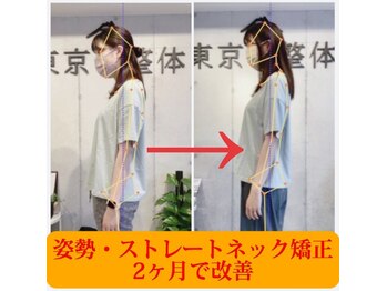 東京G整体/ビフォーアフター