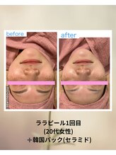 クローバー(clover)/美白・水光肌・赤み鎮静