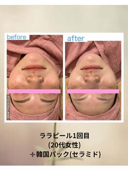 クローバー(clover)/美白・水光肌・赤み鎮静