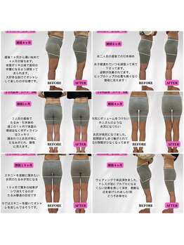 ビジリンヌ/ダイエット　広島市