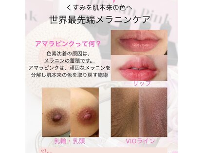フジモトサロン 那覇おもろまち店(fujimotoサロン)の写真