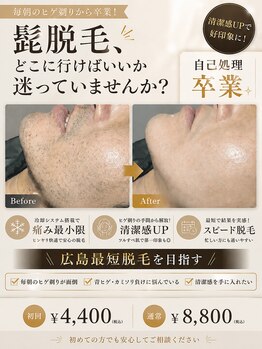 プリエ(Prier)の写真/広島で最短ヒゲ脱毛を目指すならprierで!青ヒゲ・毎朝の自己処理から卒業!
髭脱毛で美肌にも♪