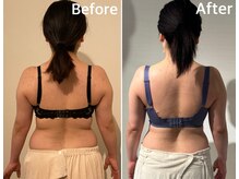 ラビス(RAVIS)/30代☆背中二の腕メリハリ痩せ