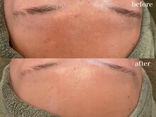 リボーン 浜松(reborn)/