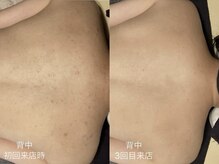 サロン デ ミロ(Salon de Miro)/BeforeAfter多数！ブログへGO♪