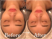 R-1ビューティーサロン 表参道/Before＆After