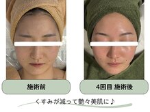 翌日からメイク可能です◎