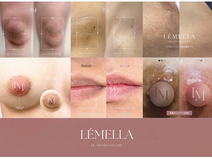 ピュアソル(Puresol)の写真