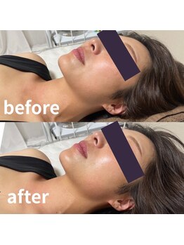 ハートランド(HEARTLAND)/