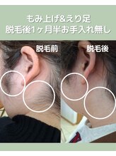 ララエピ/1回ずつのお支払いで不安なし☆