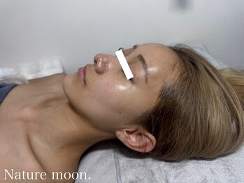 ナチュールムーン(Nature moon.)/ハーブピーリング after