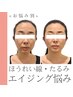 お悩み別★【たるみ・ほうれい線・エイジング悩みに】リフトアップ小顔矯正　