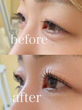 ハーズプラス(hers+)/