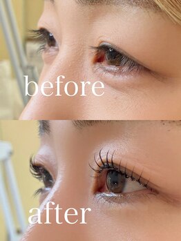 ハーズプラス(hers+)/