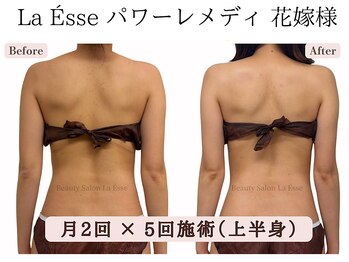ラエッセ(La Esse)/ブライダル・肩甲骨