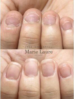 マリーロール 天王寺店(Marie Laure)/自爪育成/深爪矯正/ネイルケア