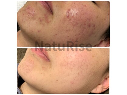 ナチュライズ(NatuRise)の写真