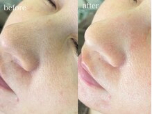 テオリア(TEORIA)/