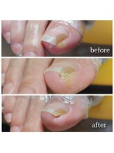 爪切り屋 足楽/