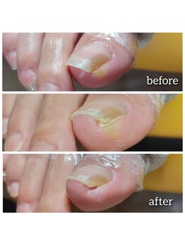 爪切り屋 足楽/