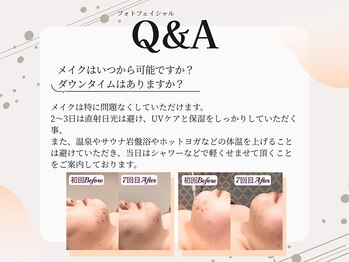 アイラブワン(eye love one)/気になるQ＆A　メイクして良い？