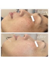 ラディエンス 多治見店/リアボーテマーメイドセルエステ