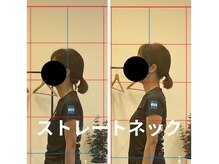 カワル整体 長嶺院/ストレートネック