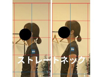 カワル整体 長嶺院/ストレートネック