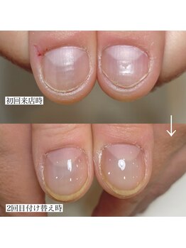 フェミニンネイル(Feminine Nail)/