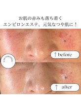 ユヌランコント 岐阜店(Une rencontre)/エンビロンエステ