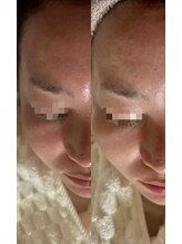 ナチュリー(Naturry)/小顔、弾力、水光肌へ。
