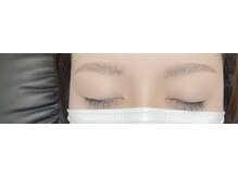 ブルーム(BLOOM)/blowLift