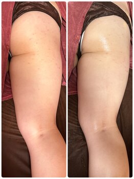 ビマリア(美-MARIA)/デトックス美BODY 痩身