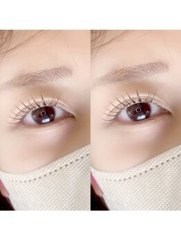 プラセル(placer)/