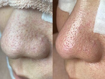 ルシェリア(Le cherien)/