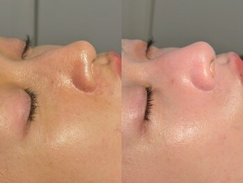 ルーナジェーナ(Luna llena)/池袋 エステ ルーナジェーナ