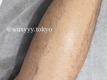 ワクシー 麻布十番店(WAXYYY.)/【メンズ脚W脱毛】