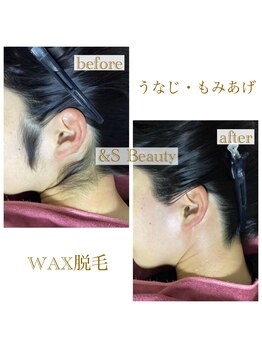 アンドエスビューティ(&S Beauty)/赤みが出にくいWAX脱毛