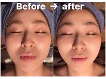 カンコルギセラピー 広島幟町店(KAN)/No1小顔コルギ