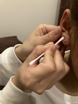 ファーストスター(First Star)/耳つぼジュエリーいかがですか?