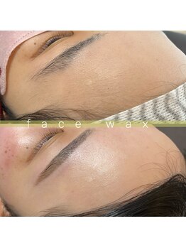 フー 広島(Fuu)/*