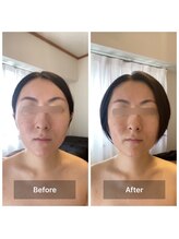 パピヨン(papillon)/ビフォーアフター