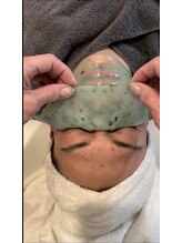 カシェットベルメイユ 名古屋久屋大通(Cachette Vermeil)/緑マスク/ニキビ.赤み.皮脂対策