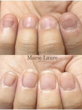 マリーロール 天王寺店(Marie Laure)/自爪育成/深爪矯正/ネイルケア